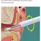Oorreiniger met camera
